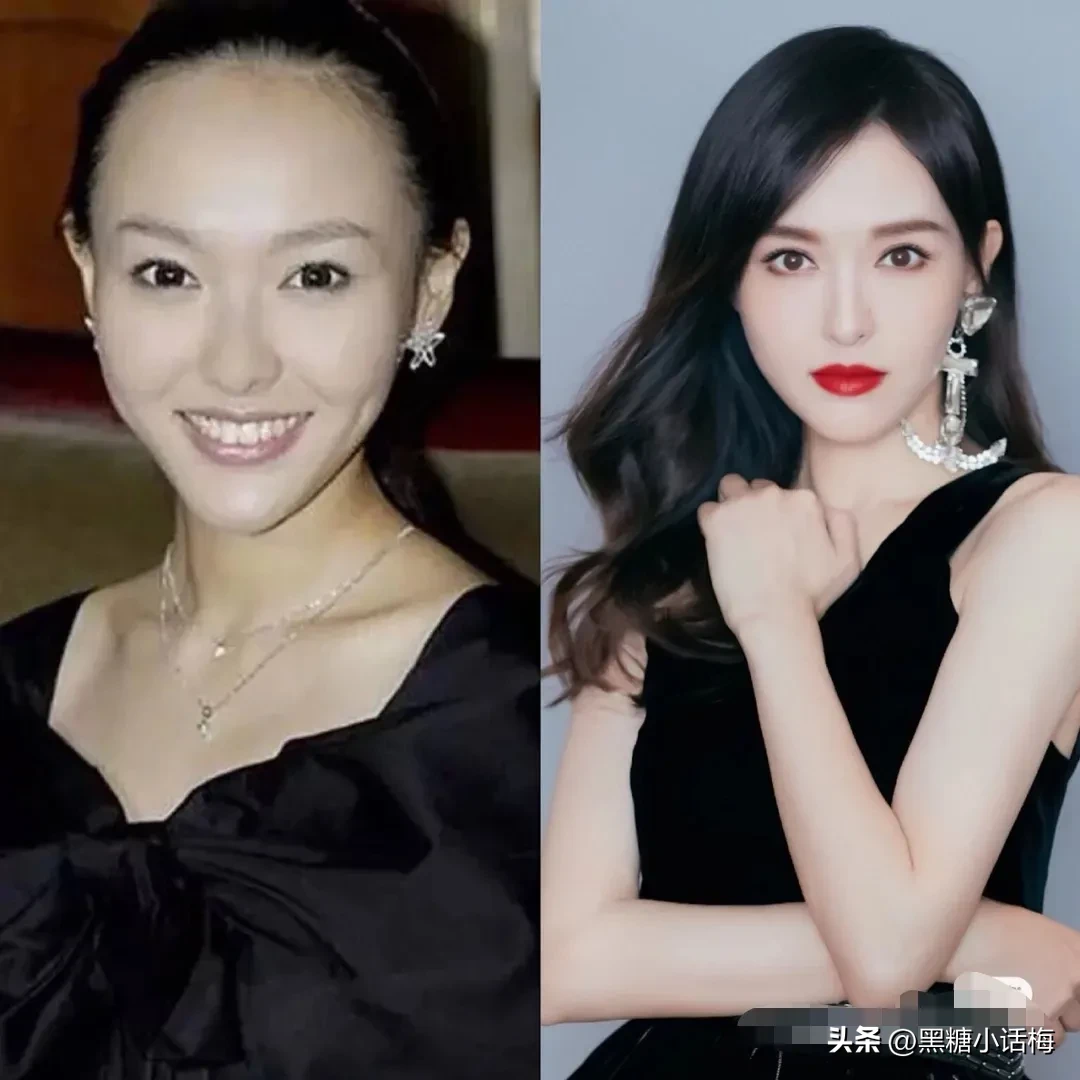 发际线对女演员颜值有多大？看看她们吧！ 唐嫣额头