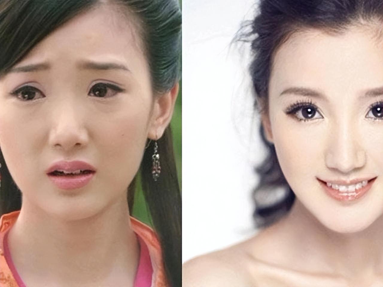 为什么说“整容”和“不整容”区别很大？看完后终于