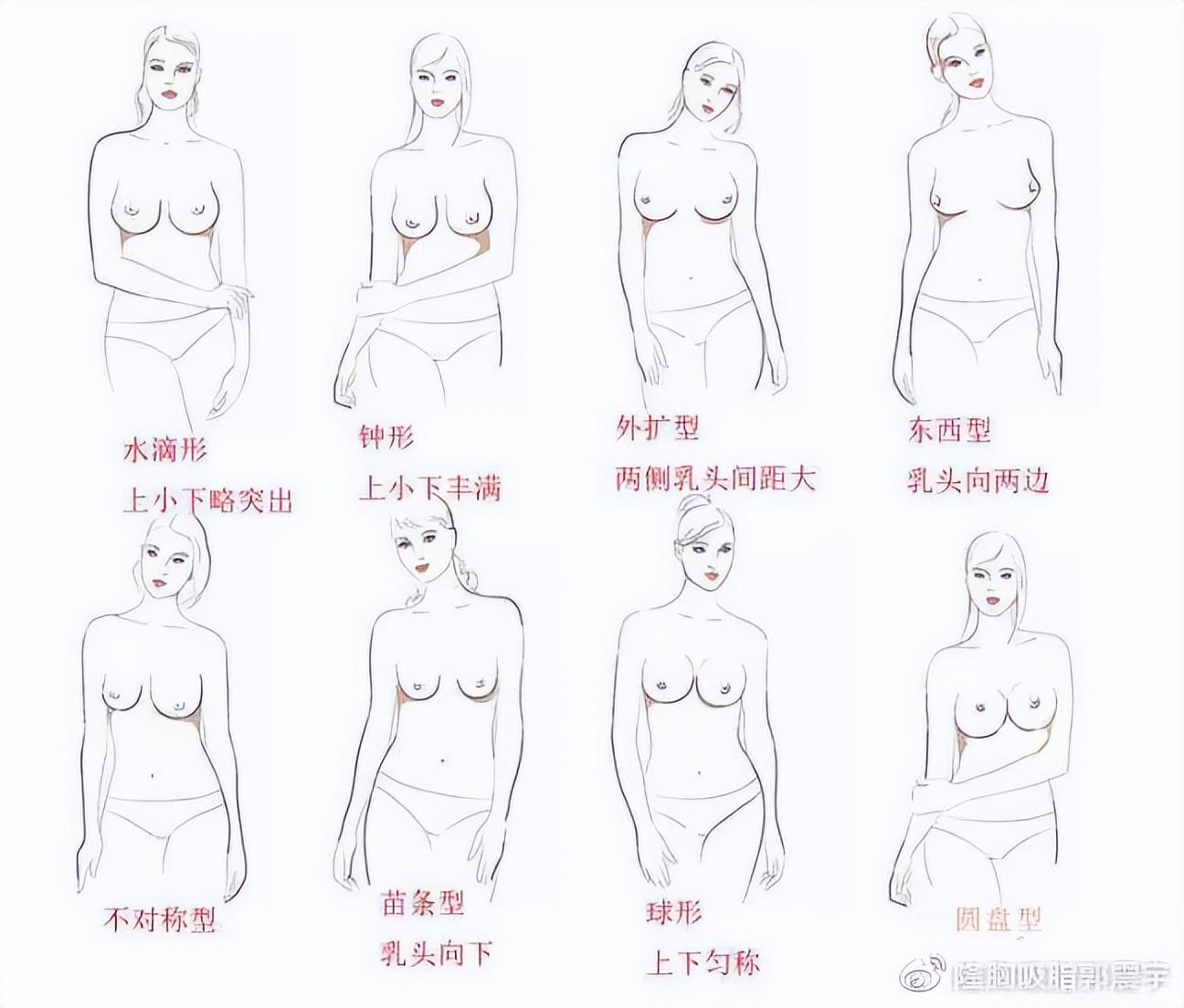 为什么要重视隆胸的术前设计？