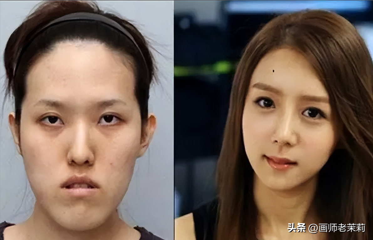 韩国医美惊悚的前世今