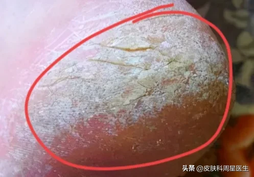 星哥聊护肤_皮肤科周星医生_2022年10月20