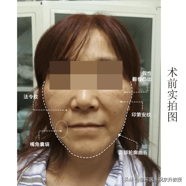 健康科普大赛_整形医生祝东升教授_2022年10月20